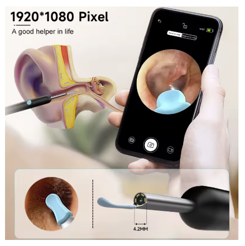 Aparat pentru curatarea urechilor Otoscop cu iluminare LED si camera incorporata