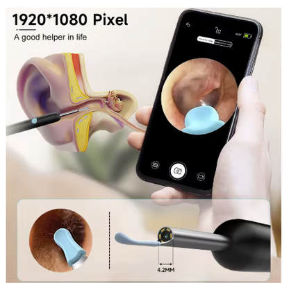 Aparat pentru curatarea urechilor Otoscop cu iluminare LED si camera incorporata