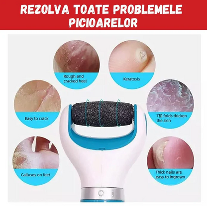 PILA MAGICA PENTRU NETEZIREA CALCAIELOR