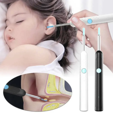 Aparat pentru curatarea urechilor Otoscop cu iluminare LED si camera incorporata